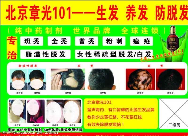 治疗秃发北京章光101海报